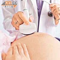 超聲波檢查有助及早識別胎兒結構異常或患遺傳病的風險。