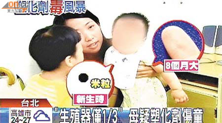 台灣一名八個月大男嬰的生殖器官只是正常者的三分一，其母懷疑是她長期飲用受污染的益生菌有關。	（電視畫面）