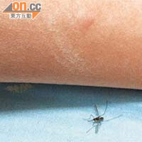 叮人後遭「捕獲」蚊隻體積龐大，倘大量繁殖後果不堪設想。