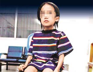 6歲女得棚骨