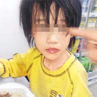 童童被發現遭後母虐待至皮包骨後，在便利店獲贈飯盒充飢。	（互聯網）