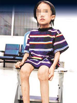 腳仔瘦得可憐的童童在救助站內與工作人員談及遭遇。	（互聯網）