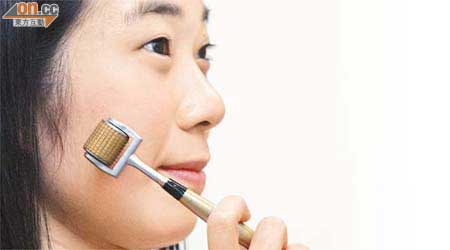 愛美人士提防微針美容可導致細菌感染等風險。 （翁志偉攝）