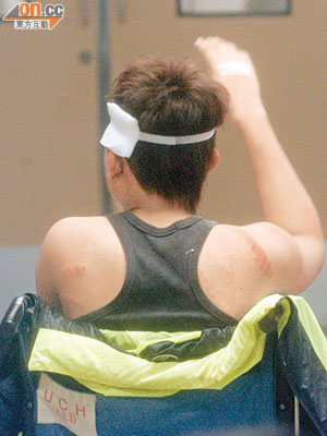 青年背部有多條明顯的鐵鏈傷痕。