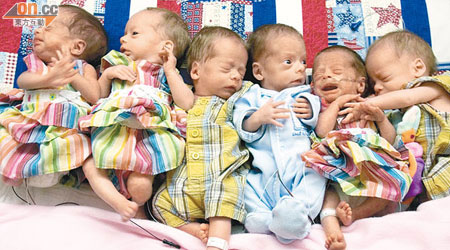 人工受孕技術令多胞胎在過去十年大增。（資料圖片）