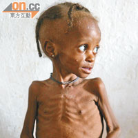第三世界國家兒童飢餓問題嚴重，法官昨形容小浩民死前情況比第三世界兒童更恐怖。（資料圖片）