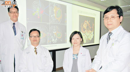 中大研究發現，放射手術有效治療腦動靜脈畸形。左起：魏遠勤、黃國柱、蕭容媛、甘冠明。