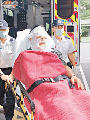 燒傷男子臉部受傷，救護員為他敷上面膜防止感染。（吳遠輝攝）