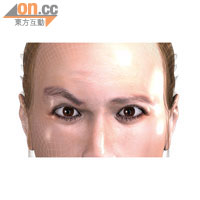 眉骨上的額神經線，負責控制眉毛，受傷後眉下肌肉會失去控制，造成高低眉。