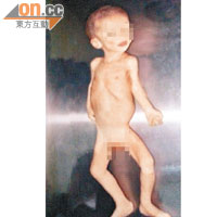 法官形容小浩民死時的皮包骨狀況，比第三世界的飢餓兒童更差。