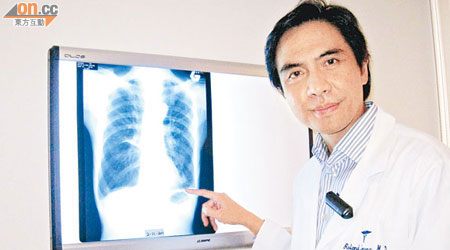 梁宗存指慢阻肺病患者的肺部因長期發展，肺內壁會腫脹，引致呼吸困難。