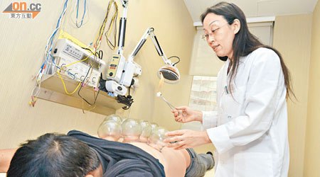 中大中醫學院專業顧問袁軍醫師示範拔火罐治理感冒。