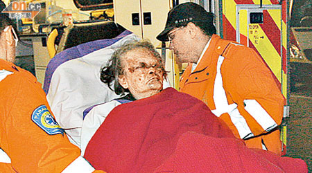 受傷老婦送院時陷入半昏迷狀態。（何力棋攝）