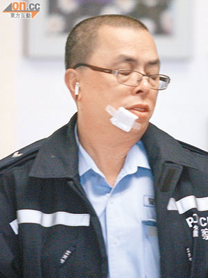 被人用煙頭灼傷下顎的警員送院治理。