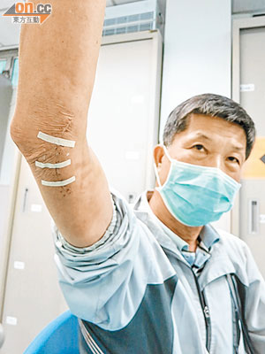 手術後，陳先生感右手麻痹及疼痛加劇，影響日常生活自理能力。