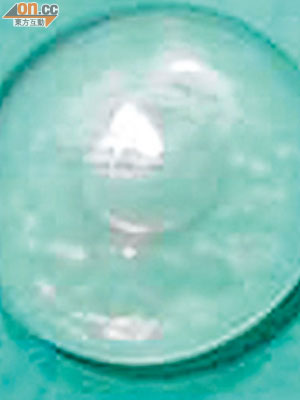 果凍矽膠<br>隆胸的矽膠及水袋在X光造影中造成陰影，影響診斷。（資料圖片）