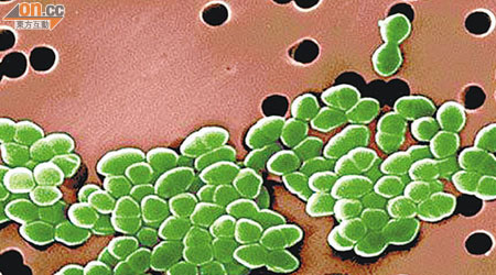 近年帶有抗萬古霉素腸球菌個案急增。