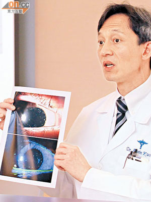 郭坤豪表示取得眼科醫生的資格需時，導致醫生數目供應不足。（資料圖片）