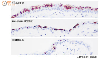 人類支氣管上皮組織<br>研究人員發現H7N9病毒可造成較大範圍的細胞感染。（香港大學醫學院提供）
