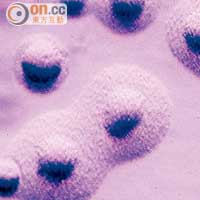 感染肺炎黴漿菌可致嚴重肺炎。