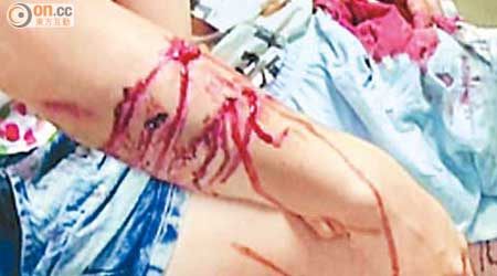 過往曾發生多宗藏獒咬傷人意外，兩年前南京一名兩歲男童被咬傷生殖器及腹部。