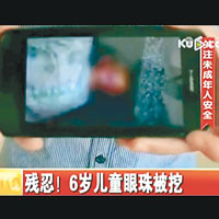 家屬向傳媒展示小斌斌被發現時血流滿面的慘況。（電視畫面）
