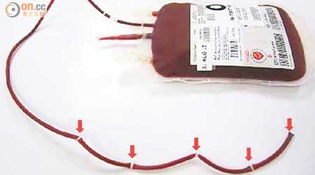 紅會採取新血包膠管設計，增加預製分段（箭嘴示），方便配血。
