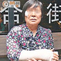 右手受傷的女事主講述被流浪牛撞倒的經過。（吳欽旺攝）