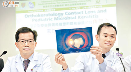 楊樂旼（右）指，不當佩戴OK鏡可致角膜受損，左為譚智勇。
