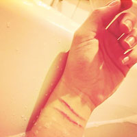 梁齊昕於上月底把鎅手自殘相片上載至社交網站，惹起極大回響。（互聯網圖片）