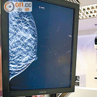 新一代3D乳房Ｘ光造影利用斷層技術，準確度較傳統造影高五成。
