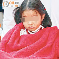 面部被鎅傷的幼女送院時神情呆滯。