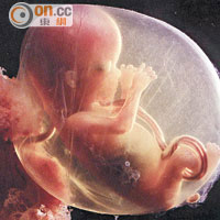 CAH女患者身體產生過多男性賀爾蒙，在胎兒階段會發展出類似男性陰莖的外生殖器。（資料圖片）