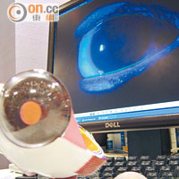 眼角膜疾病嚴重可致失明，市民應小心保護靈魂之窗。
