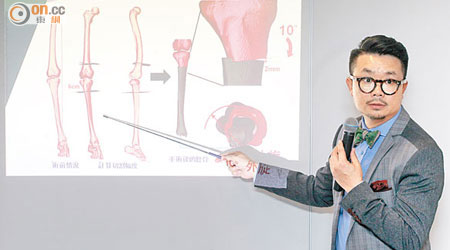 廖敬樂引入3D打印技術輔助下肢矯形手術，縮短病人住院及康復時間。（黃永俊攝）