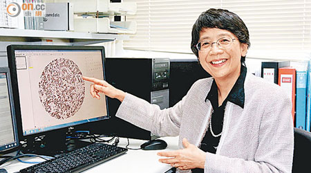 邱瑋璇與團隊發現乳癌基因有機會剪接成BQ變體，或增腫瘤抗藥性。