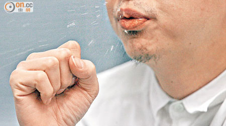 肺癆患者咳嗽、噴出飛沫可傳播結核菌。（資料圖片）
