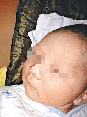 有內地網民指其嬰兒被閃光燈灼傷致盲。（互聯網圖片）