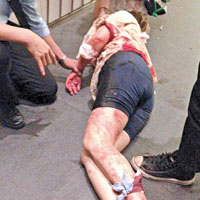 有傷者手腳受傷，躺在地上接受治療。（互聯網圖片）