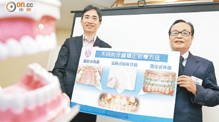 香港矯齒學會指及早發現前牙錯咬，可及時以牙箍糾正。左為劉潤華，右為梁訓成。（蘇文傑攝）