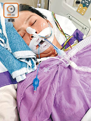 在瑪麗醫院深切治療部留醫的林嘉玲陷入深度肝昏迷。（受訪者提供）