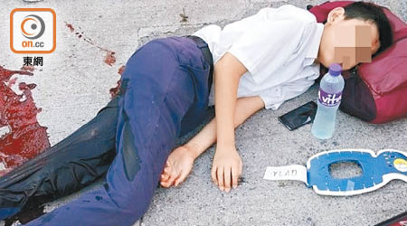 「自炒」單車受傷學童倒臥地上，血流如注。（網民Fish Plus Oyster提供圖片）