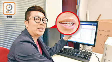 劉國勳貪靚去箍牙，就快完成兩年療程。（徐家浩攝）