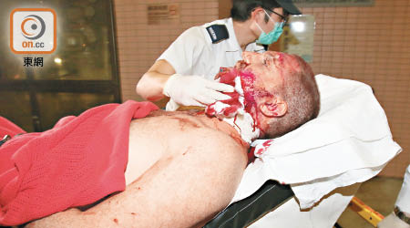 傷者送院時由救護員按壓傷口止血。（林耀康攝）