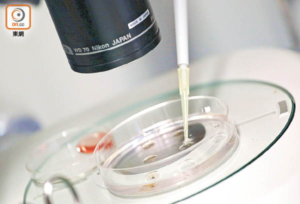 最新儀器以「單細胞基因技術」檢測卵子質素。