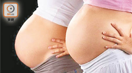 研究發現，孕婦若體重超標或影響子女壽命。（資料圖片）