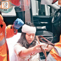 平治輕型貨車的女乘客受傷。