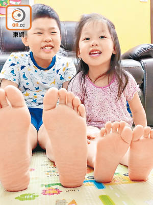 兒童免疫系統未成熟，抵抗力較差，易感染疣，家長要注意子女「大腳板」的衞生。