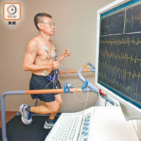 運動心電圖可確診心房顫動的情況。（資料圖片）