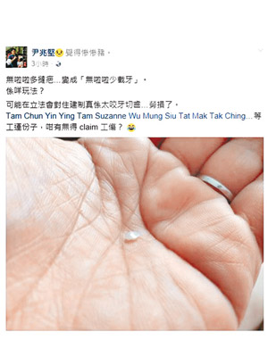 尹兆堅於Facebook自爆玩到崩咗一截門牙。（互聯網圖片）